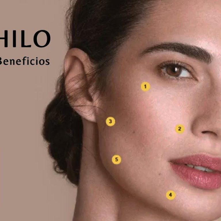 Profhilo